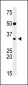 SLUG Antibody (Center)